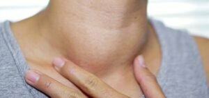 Symptoms Treatment for Head and Neck Cancers